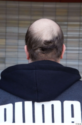 Head Hair Man White Casual Chubby Bald Street photo references